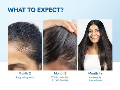 For Hair Thinning & New Hair Growth AdvancedHair Growth Serum